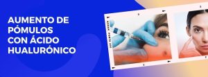 Aumento de pómulos con ácido hialuonico
