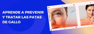 Patas de gallo, tratarlas y eliminarlas es posible en Clínica Método Estética.