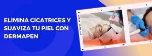 Dermapen, el tratamiento con microagujas para renovar y rejuvenecer tu piel ahora en Logroño