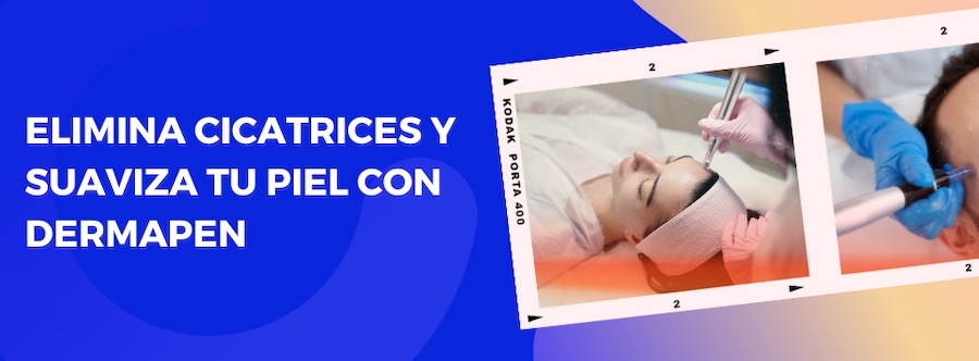 Dermapen, el tratamiento con microagujas para renovar y rejuvenecer tu piel ahora en Logroño