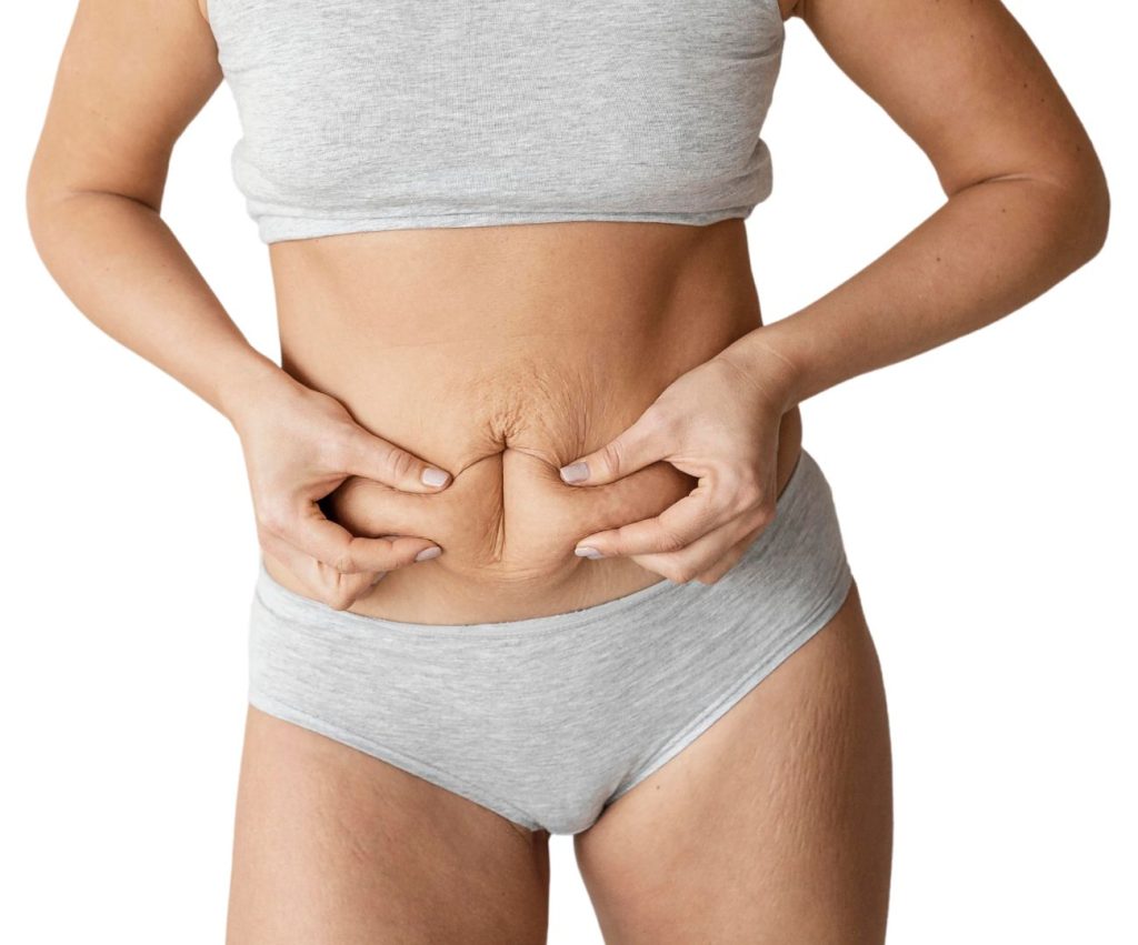 Elimina la grasa localizada con Intralipoterapia