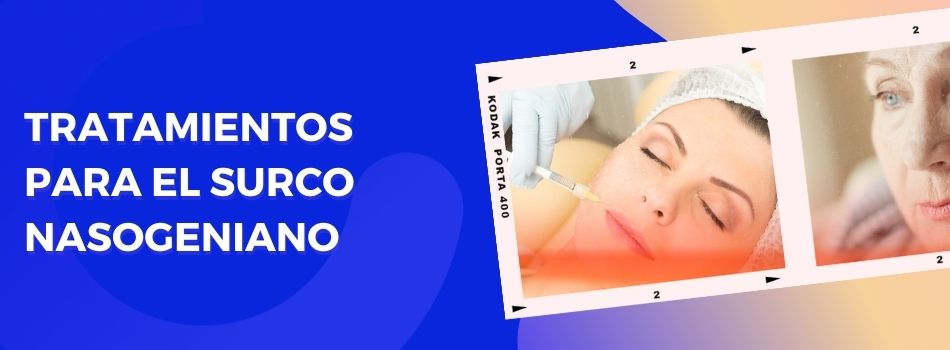 Tratamientos para el surco nasogeniano en Logroño