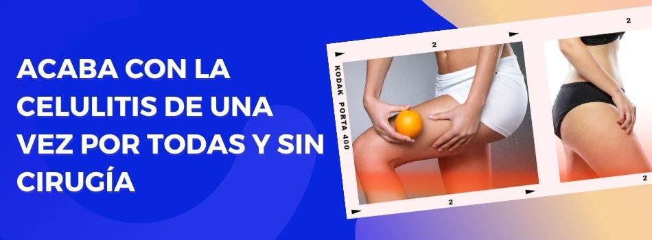 Existen tratamientos efectivos para combatir la celulitis sin cirugía