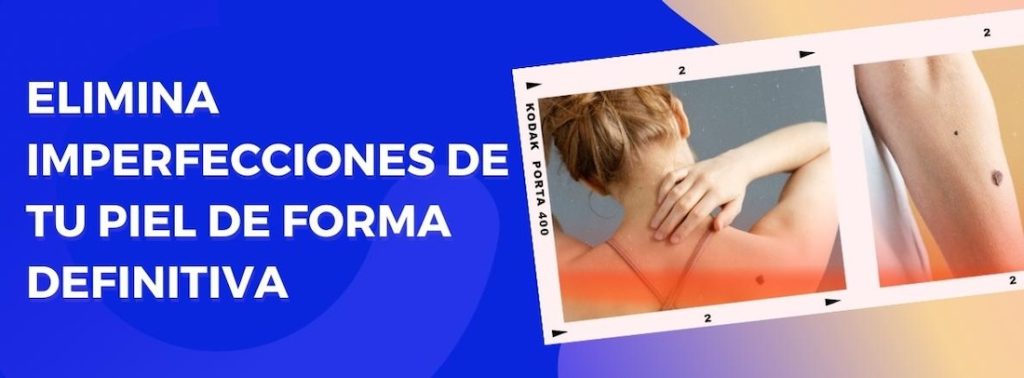 Es posible eliminar lunares y verrugas de forma definitiva con el láser de plasma.