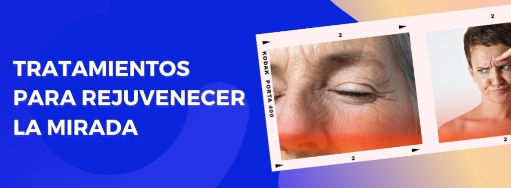 Rejuvenece tu mirada con estos tratamientos de bótox para los ojos.