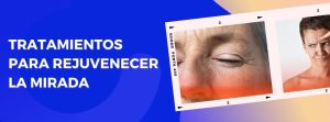 Rejuvenece tu mirada con estos tratamientos de bótox para los ojos.