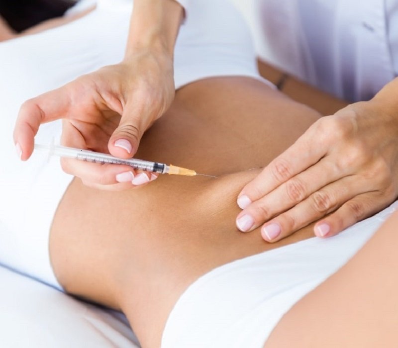 Carboxiterapia-Metodo-Estetica