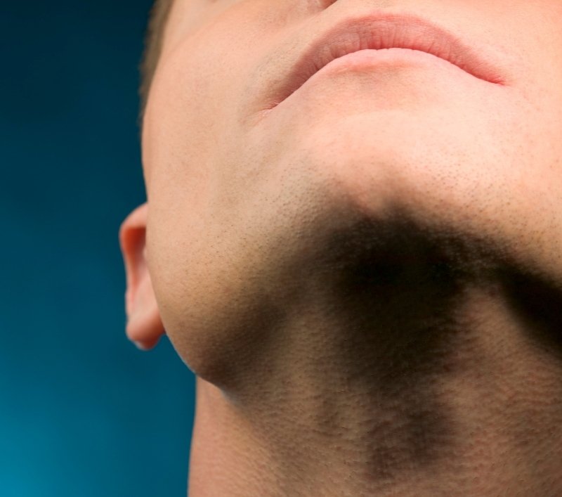 relleno-del-mentón